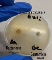 J Microbiota